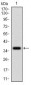 CD36 Antibody